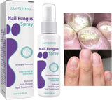 Nail Repair Spray