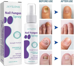 Nail Repair Spray