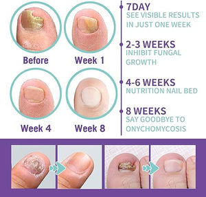 Nail Repair Spray