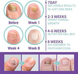 Nail Repair Spray