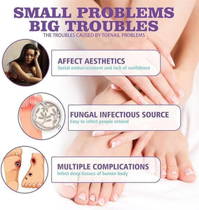 Nail Repair Spray