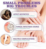 Nail Repair Spray