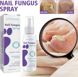 Nail Repair Spray